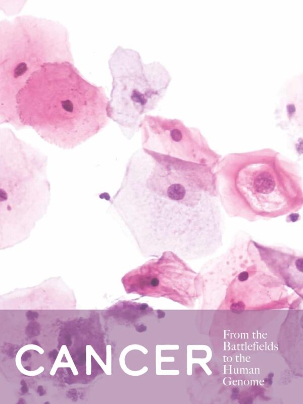 cancer